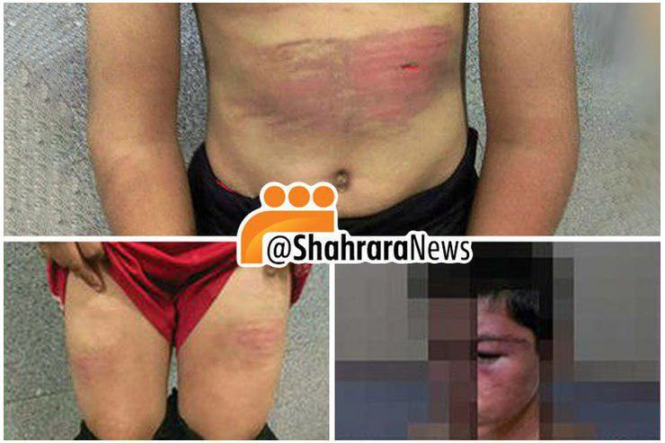 جزئیات تکان‌دهنده از شکنجه پسر نوجوان وحشت‌زده مشهدی + عکس
