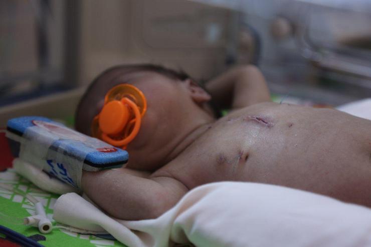 راه‌اندازی بخش جراحی قلب اطفال در بیمارستان  رضوی