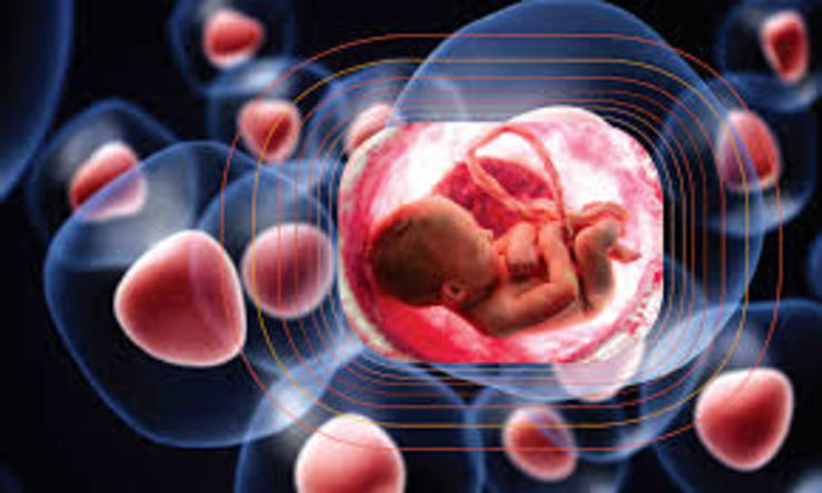 درمان یک نوزاد ۶ روزه با پیوند سلول‌های بنیادی