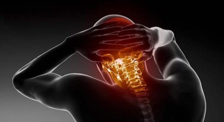 ۶ تمرین برای پیشگیری از «آرتروز گردن»
