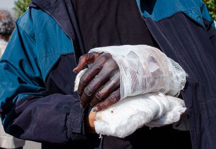 ماجرای قطع دست یک کشتی گیر توسط اراذل و اوباش + عکس