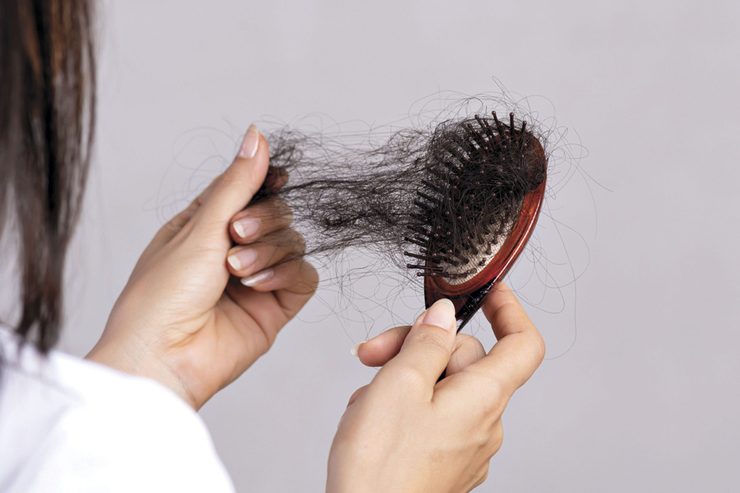 علت ریزش مو در بهبودیافتگان از کرونا + درمان