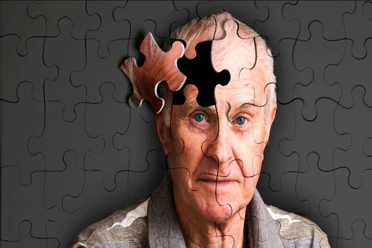 باورهای اشتباه درباره آلزایمر
