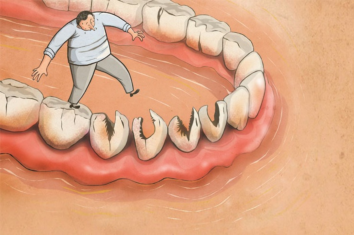 نکاتی درباره رعایت بهداشت دهان و دندان | چشم از دندان‌هایتان برندارید