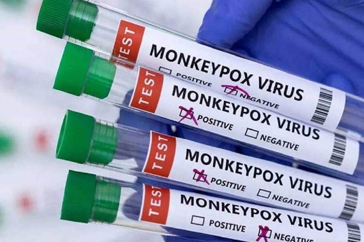 وزارت بهداشت: فعلا واکسیناسیون آبله میمون ضرورتی ندارد