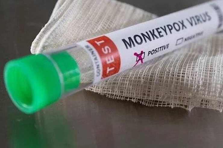 برنامه وزارت بهداشت برای خرید واکسن آبله میمونی