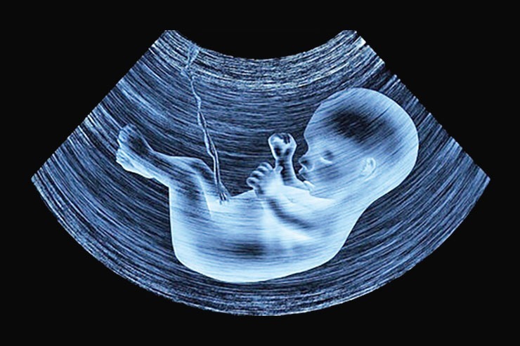 روایتی از سقط‌های عمدی و  مرکزی برای جان دادن به «نفس»‌های زندگی