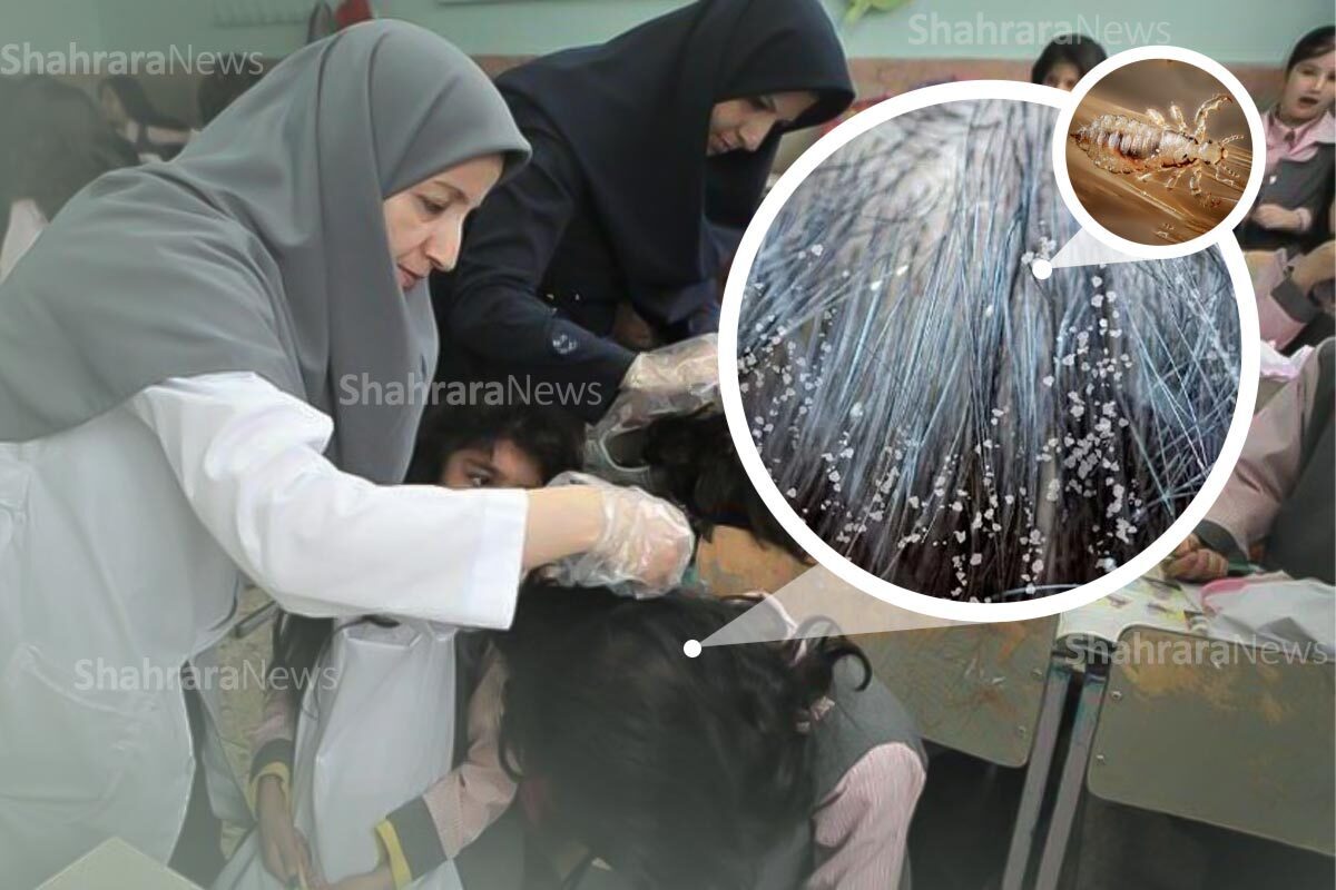 شیوع گسترده شپش در یکی از مدارس مناطق برخوردار مشهد| ۴۰ دانش آموز دختر گرفتار شپش شدند