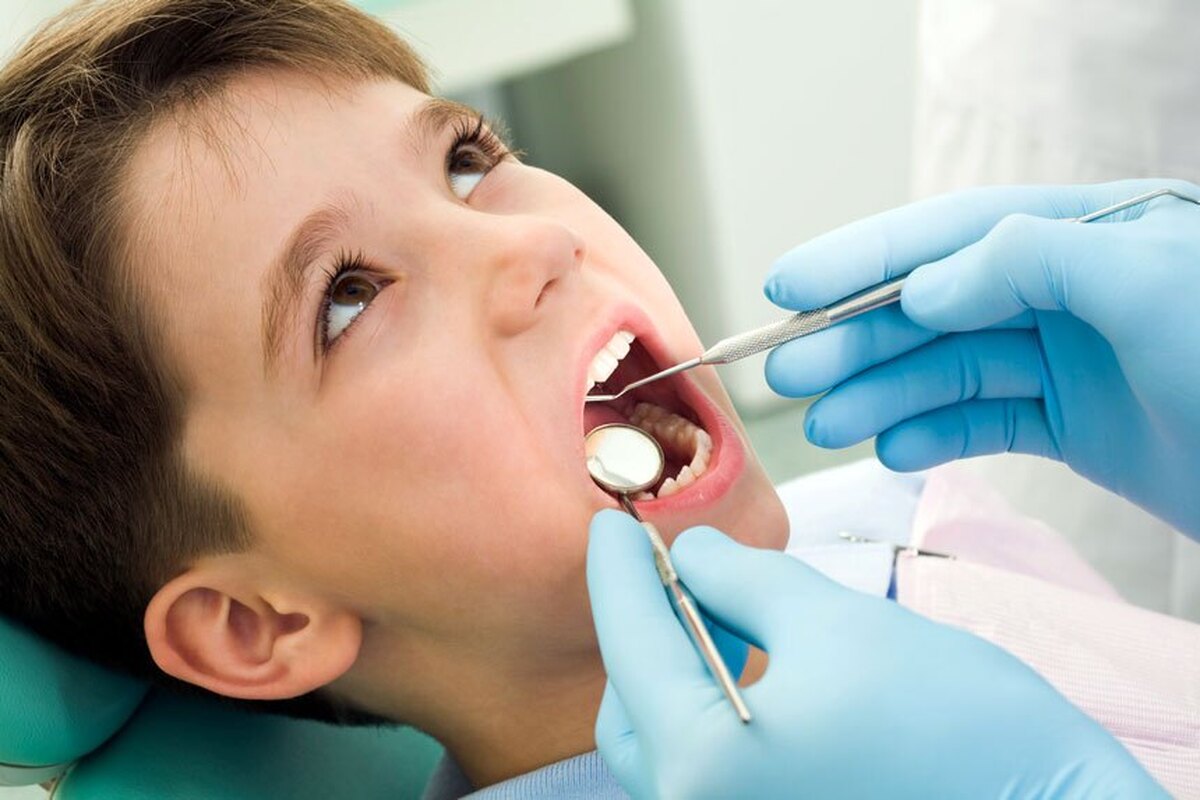 آمار بالای پوسیدگی دندان در کودکان ایرانی | ۲۰ توصیه مهم و کاربردی برای مراقبت از دندان کودک