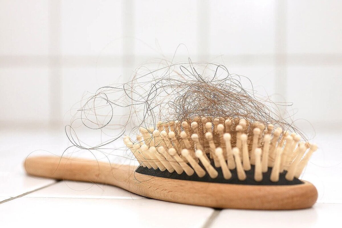 علت ریزش مو در زنان به‌دلیل کمبود کدام ویتامین است؟ | دلایل ریزش مو در زنان
